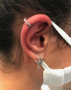 helix piercing